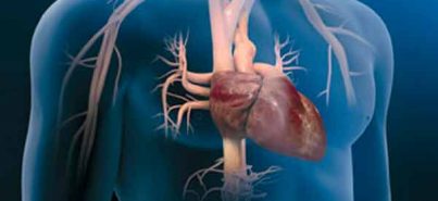 Cirugía Cardiovascular