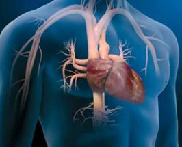 Cirugía Cardiovascular