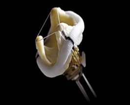 Válvulas  biológicas St Jude Medical